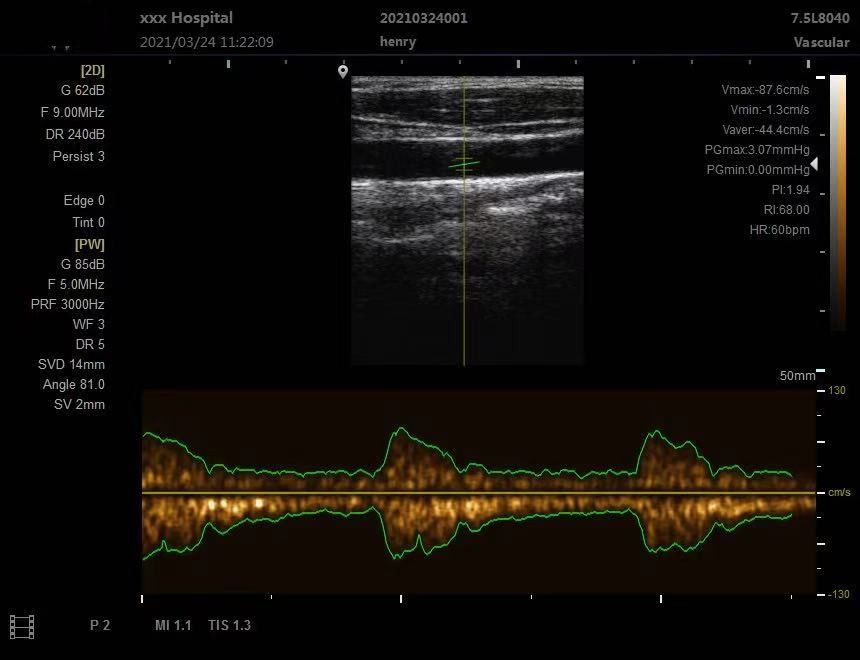Ultrasound Image Ultrasound Image