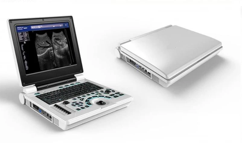 Portable Ultrsound Diagnostic System