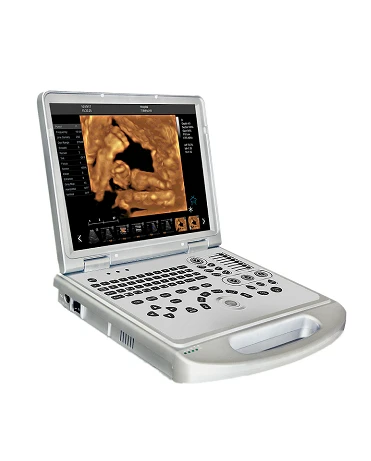 4D Ultrasound 4D Ultrasound