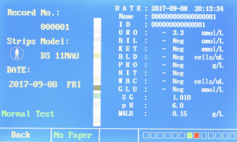 urine analyzer parameters urine analyzer parameters
