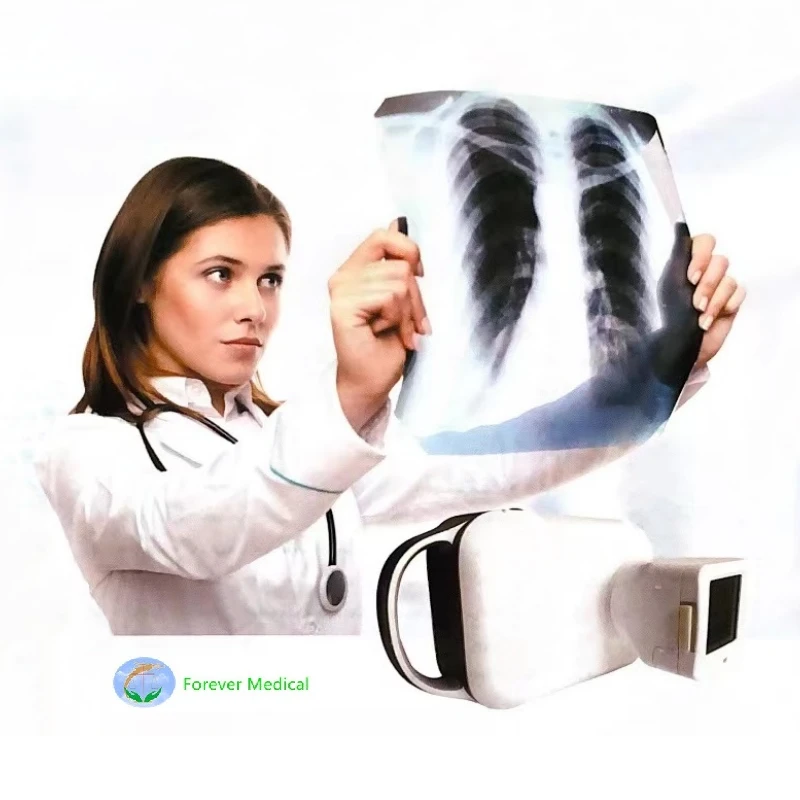 news-800-800HANDHELD X RAY MACHINE news-800-800HANDHELD X RAY MACHINE