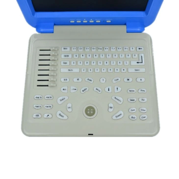 Color B Ultrasound Forermed Scanner Color B Ultrasound Forermed Scanner
