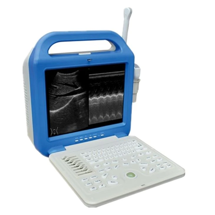 Color B Ultrasound Forermed Scanner Color B Ultrasound Forermed Scanner