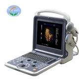 4D Bebek Taşınabilir Medikal Renkli Doppler Ultrason Makinesi