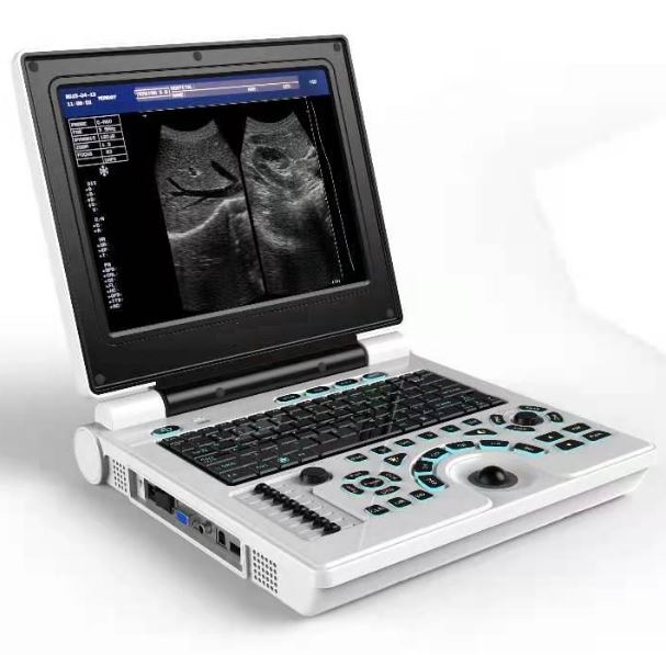 Portable Ultrsound Diagnostic System Portable Ultrsound Diagnostic System