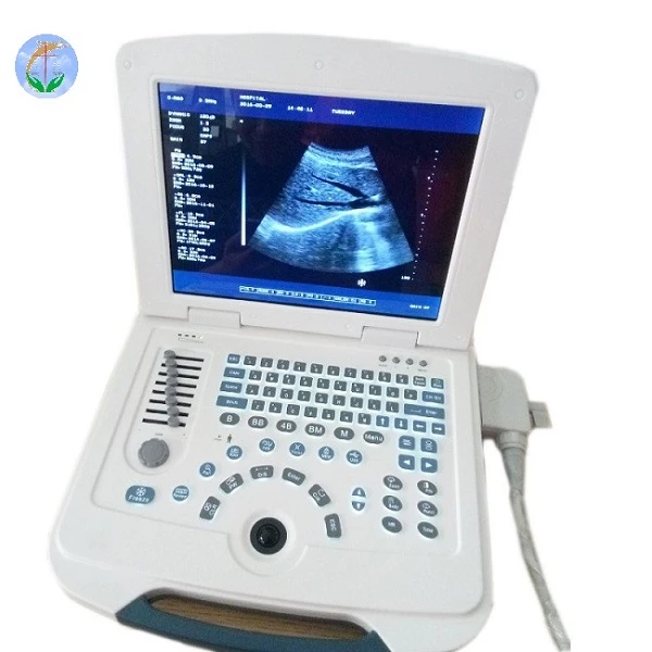 B-ultrasonik Teşhis Ekipmanı 12.1 İnç Ekran Pil 4 Saat Çalışabilir 6 Çeşit Dil Veteriner Ultrason Tarayıcı