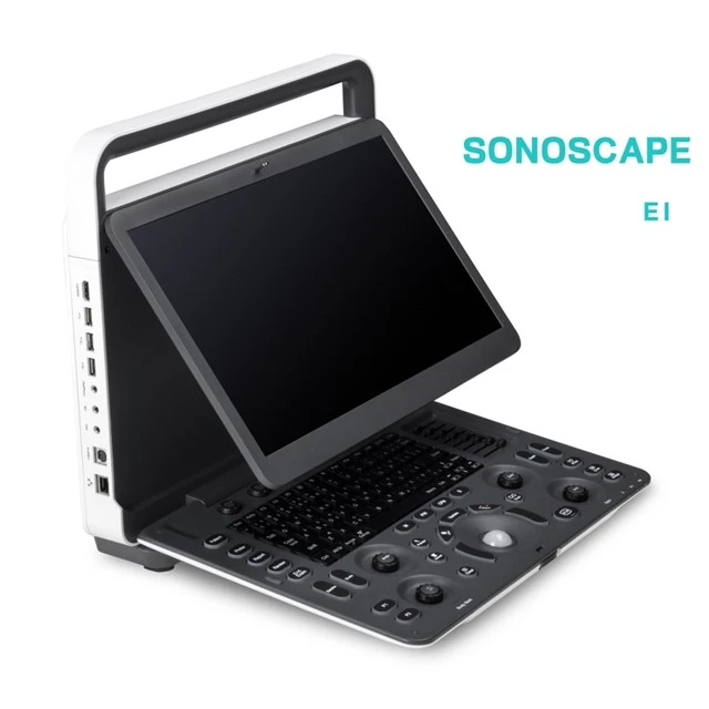 Sonoscape Ultrason Makinesi